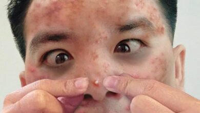 หมอแล็บ