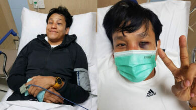 เอ็กซ์ ธิตินันท์