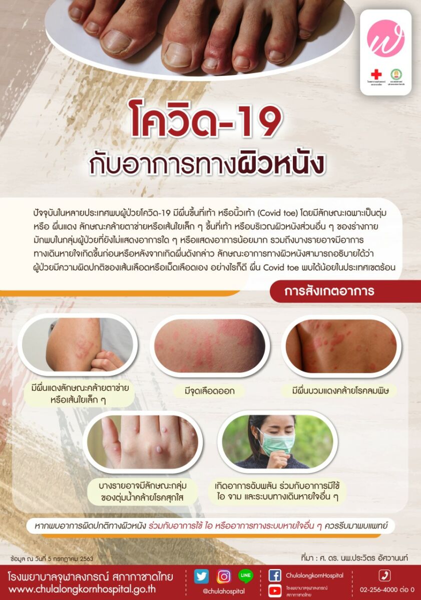 ผื่นโควิด