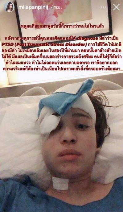 มิล่า Kamikaze