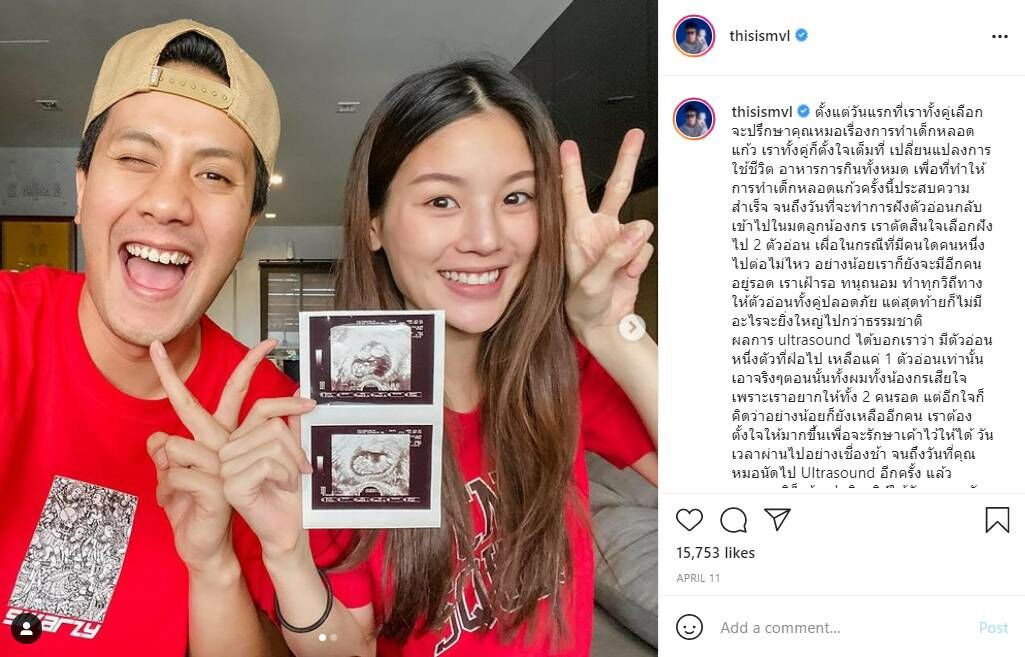 เป้ วงมาย ลูก