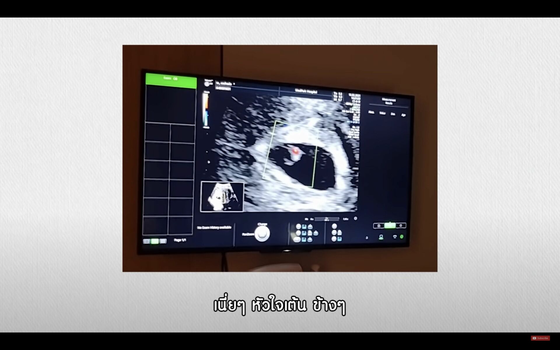 ตูน บอดี้สแลม ก้อย รัชวิน