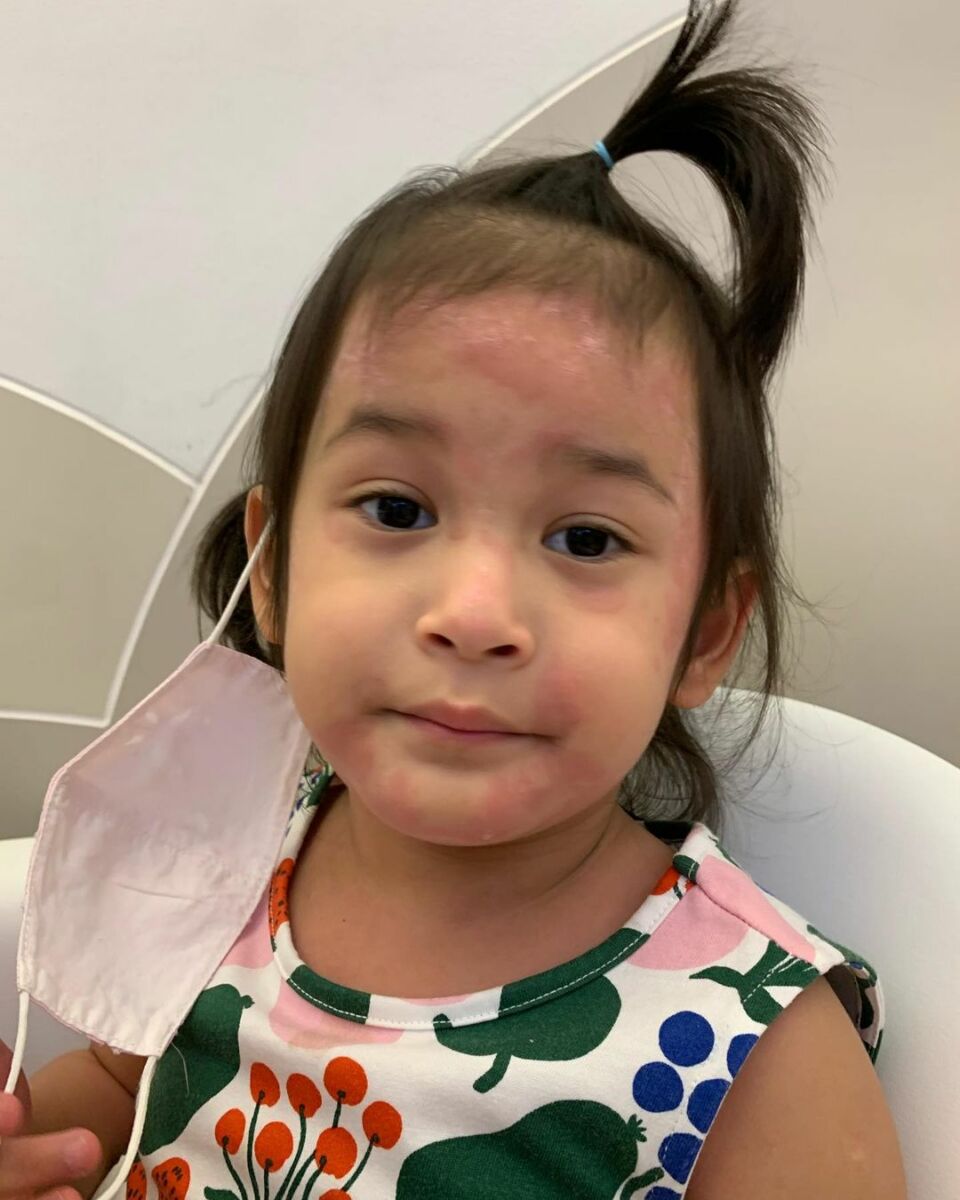 มียา ลมพิษ