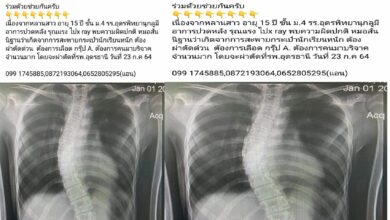 กระเป๋านักเรียน กระดูกสันหลัง