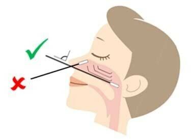 วิธีแหย่จมูกตรวจโควิด