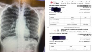 หมอรามา ติดโควิด