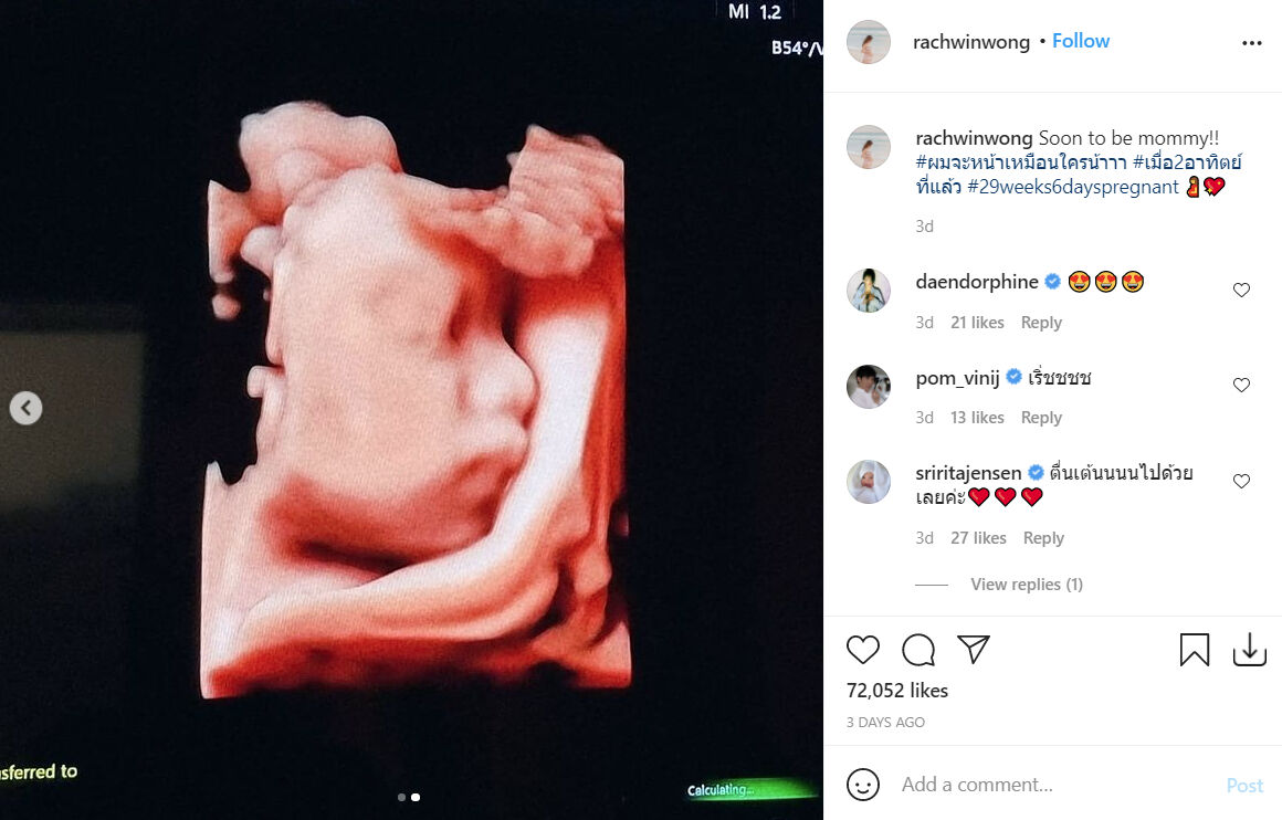 ก้อย รัชวิน