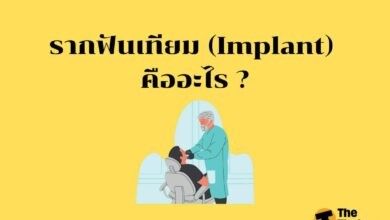 รากฟันเทียม (Implant) คืออะไร