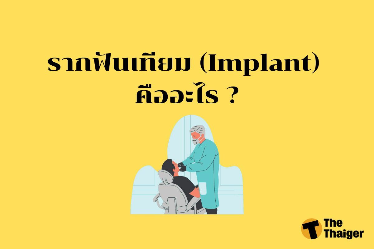 รากฟันเทียม (Implant) คืออะไร