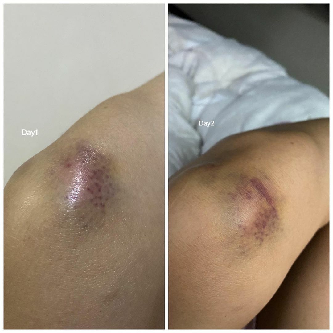 ญิ๋งญิ๋ง รถแข่ง