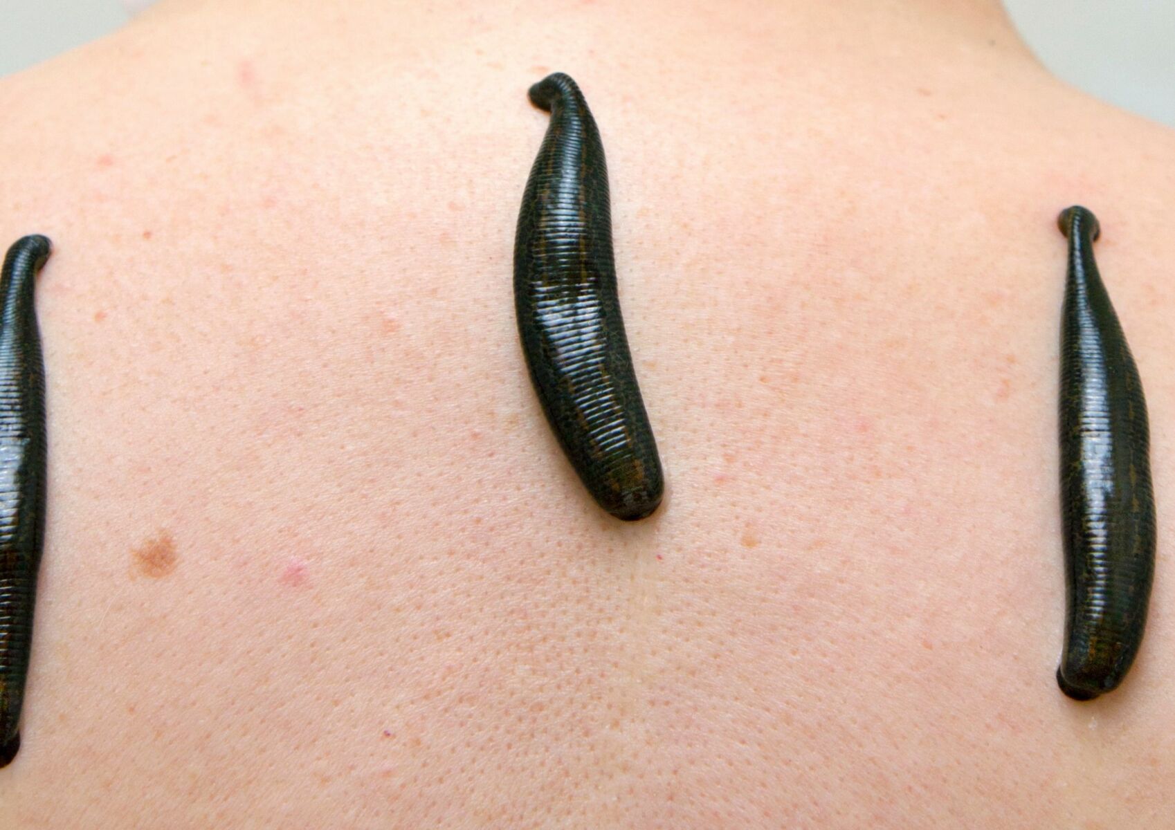 ฝันเห็นปลิงเกาะ เลขเด็ด