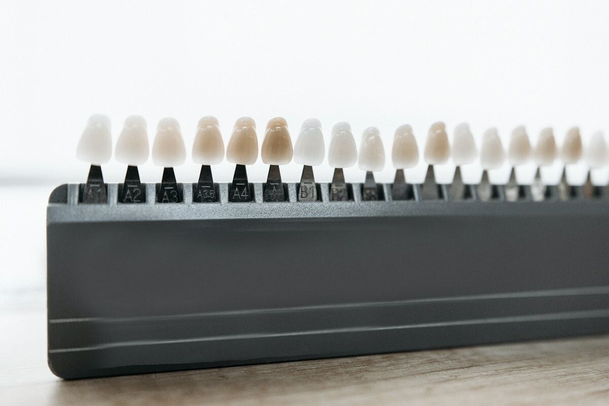 เคลือบผิวฟัน (Veneer)