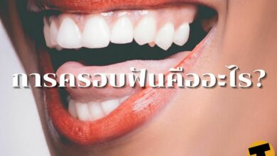 ครอบฟัน คืออะไร