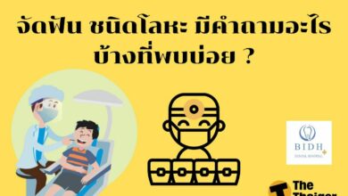 จัดฟัน ชนิดโลหะ