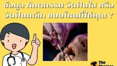 ข้อมูล ทันตกรรม จัดฟันใส หรือ จัดฟันเหล็ก แบบไหนที่ใช่คุณ ?