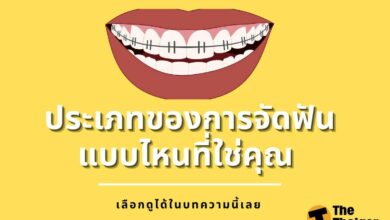 ประเภทของการจัดฟัน