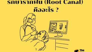 รักษารากฟัน (Root Canal) คืออะไร ?