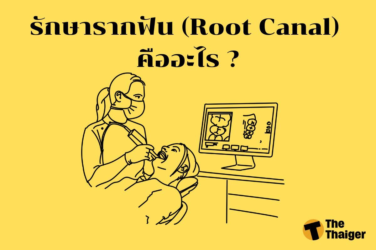 รักษารากฟัน (Root Canal) คืออะไร ?