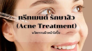 ทรีทเมนต์ รักษาสิว (Acne Treatment)