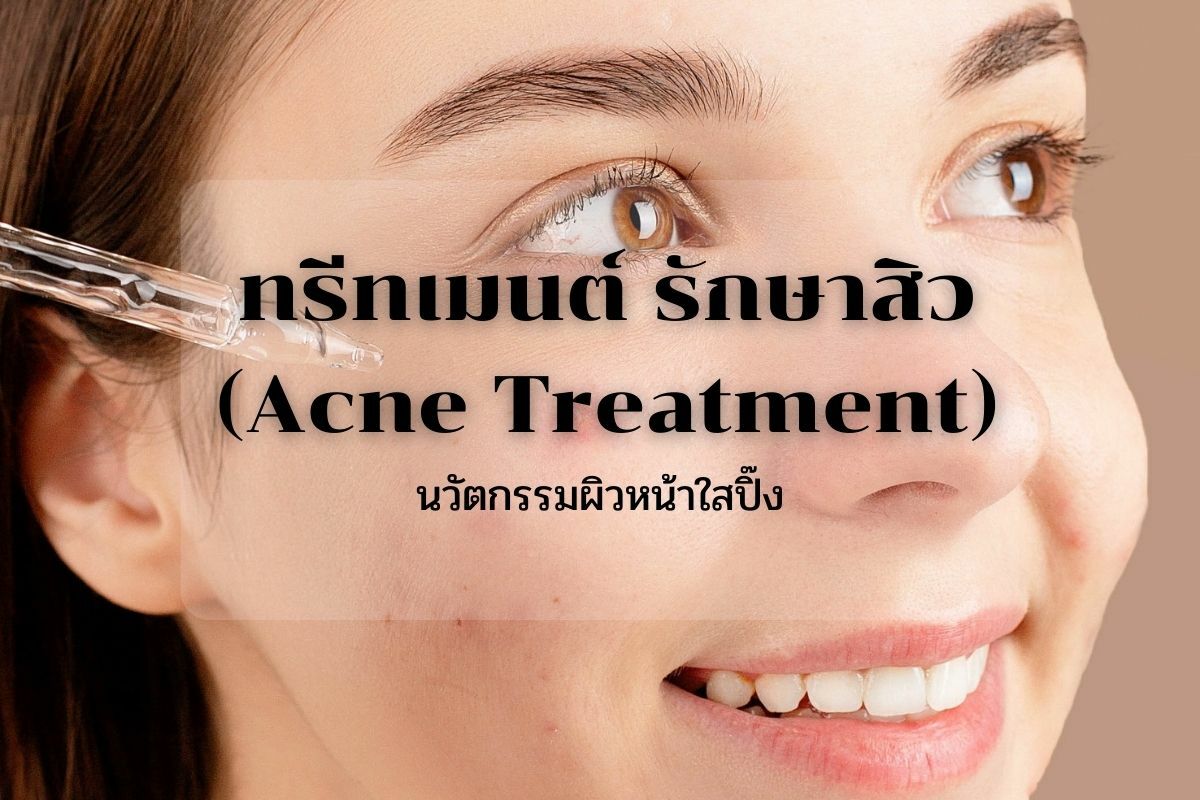 ทรีทเมนต์ รักษาสิว (Acne Treatment)