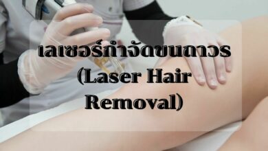 เลเซอร์กำจัดขนถาวร (Laser Hair Removal)