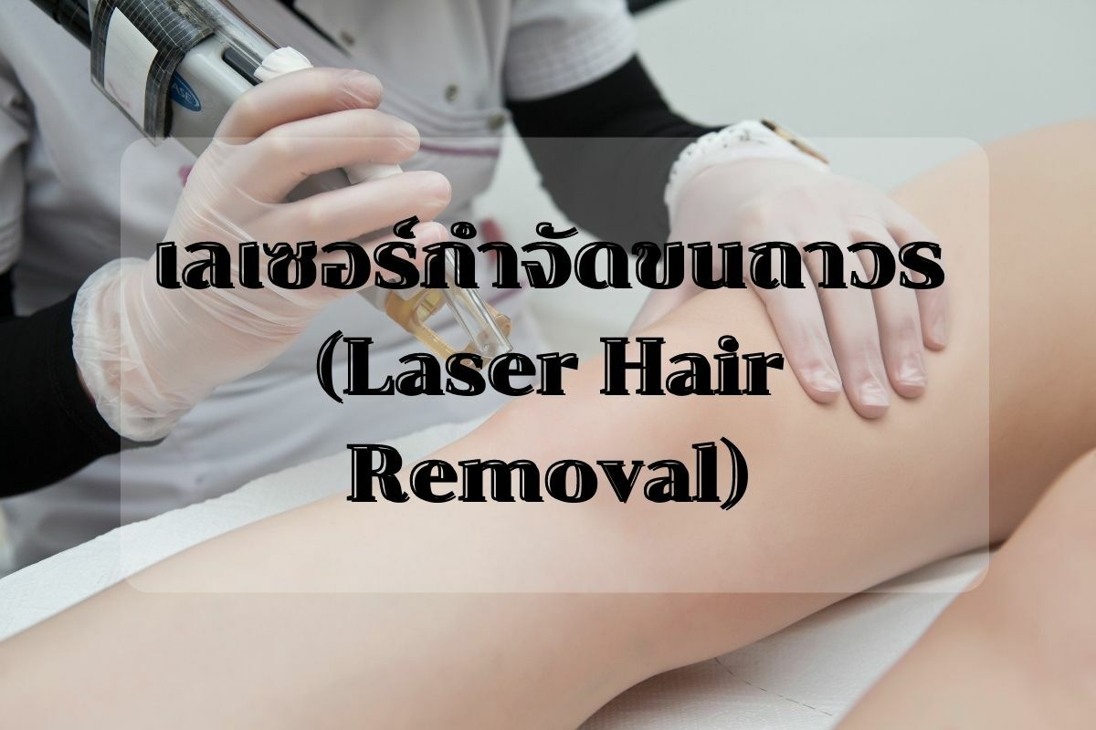 เลเซอร์กำจัดขนถาวร (Laser Hair Removal)