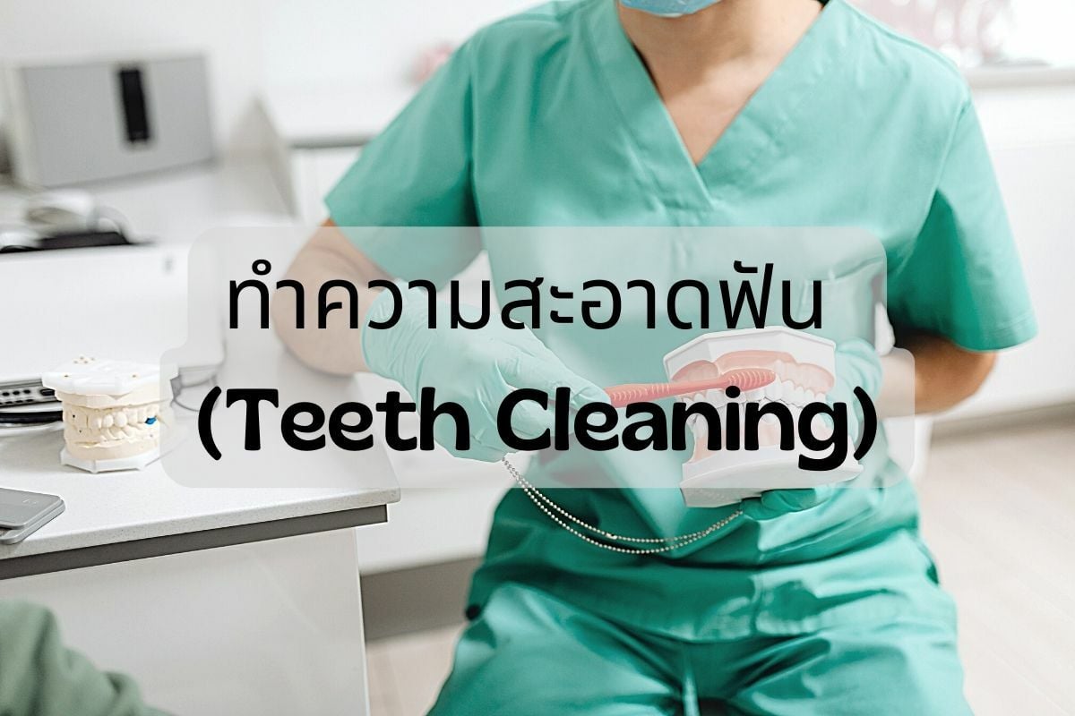 ทำความสะอาดฟัน (Teeth Cleaning)