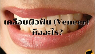 เคลือบผิวฟัน