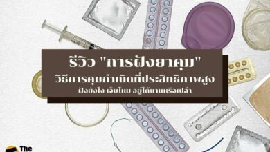 รีวิวการฝังยาคุม