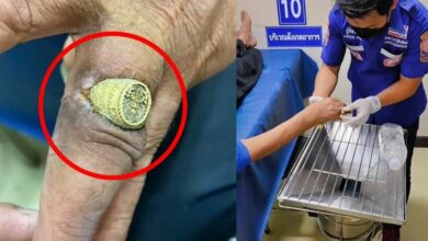 นิ้วกินแหวน นิ้วกลืนแหวน