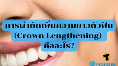 การผ่าตัดเพิ่มความยาวตัวฟัน (Crown Lengthening) คืออะไร?