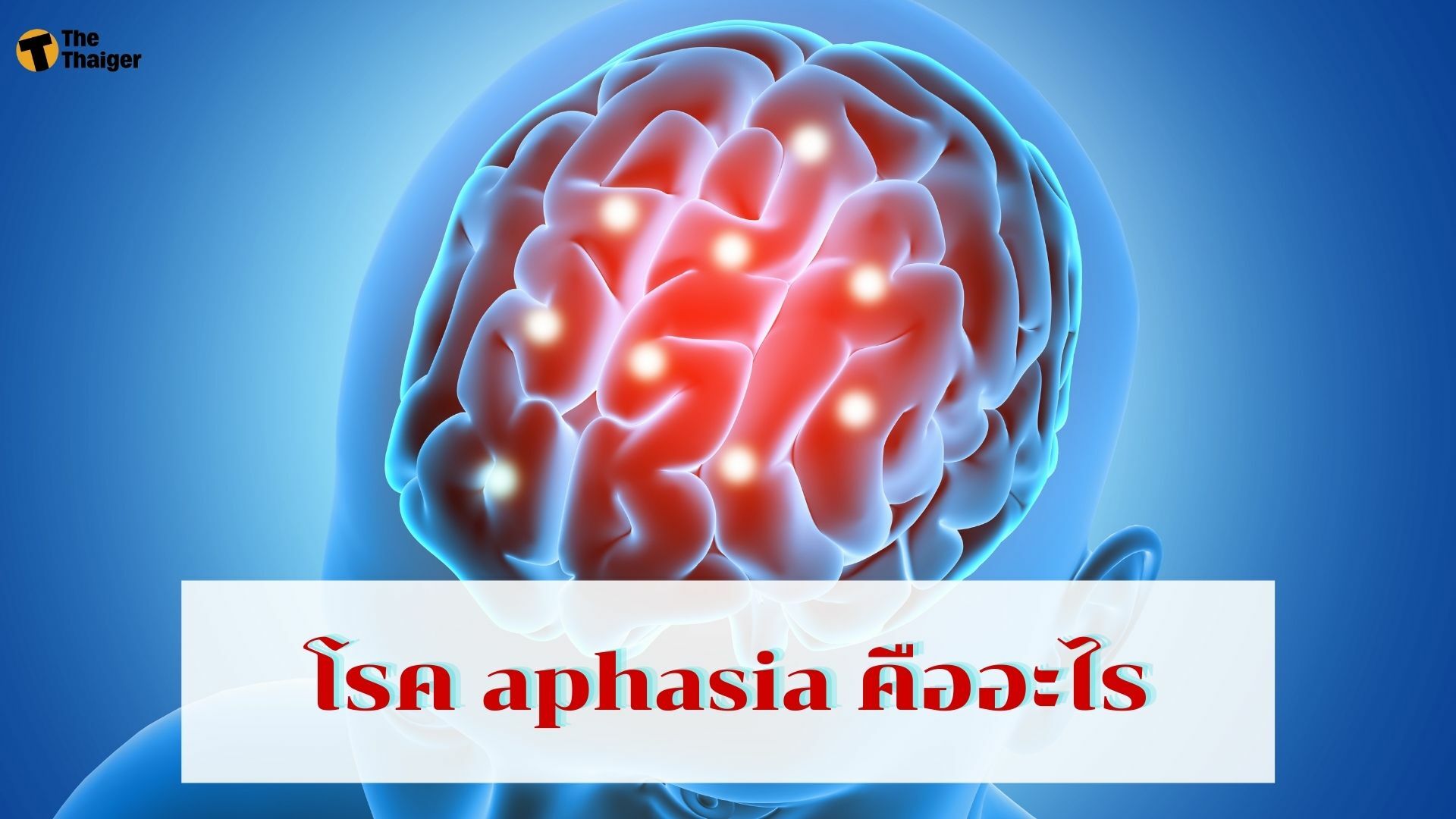 โรค aphasia คืออะไร สาเหตุ มาจากอะไร รักษายังไงได้บ้าง