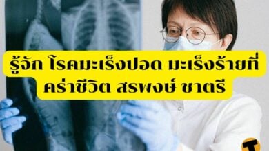 โรคมะเร็งปอด