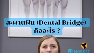 สะพานฟัน (Dental Bridge) คืออะไร ?