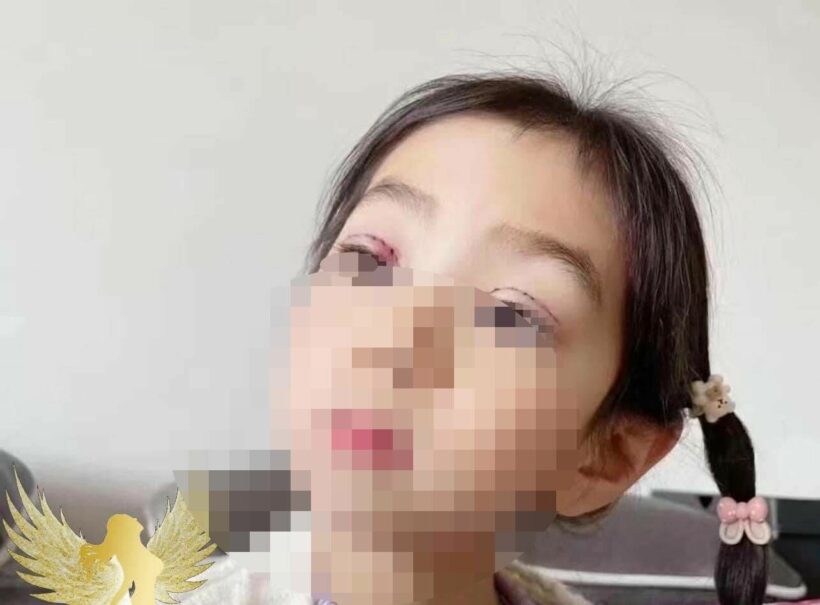 เด็กเวียดนาม ทำตาสองชั้น