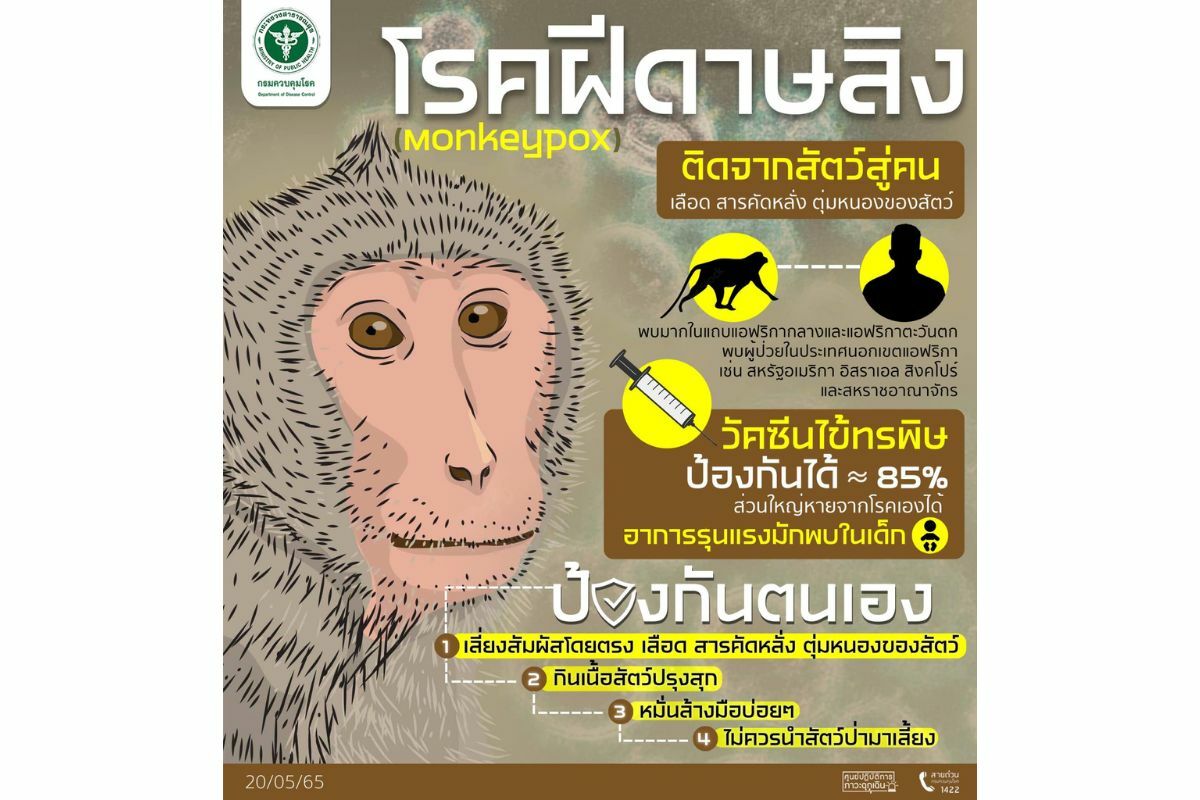 วิธีป้องกัน โรคฝีดาษลิง