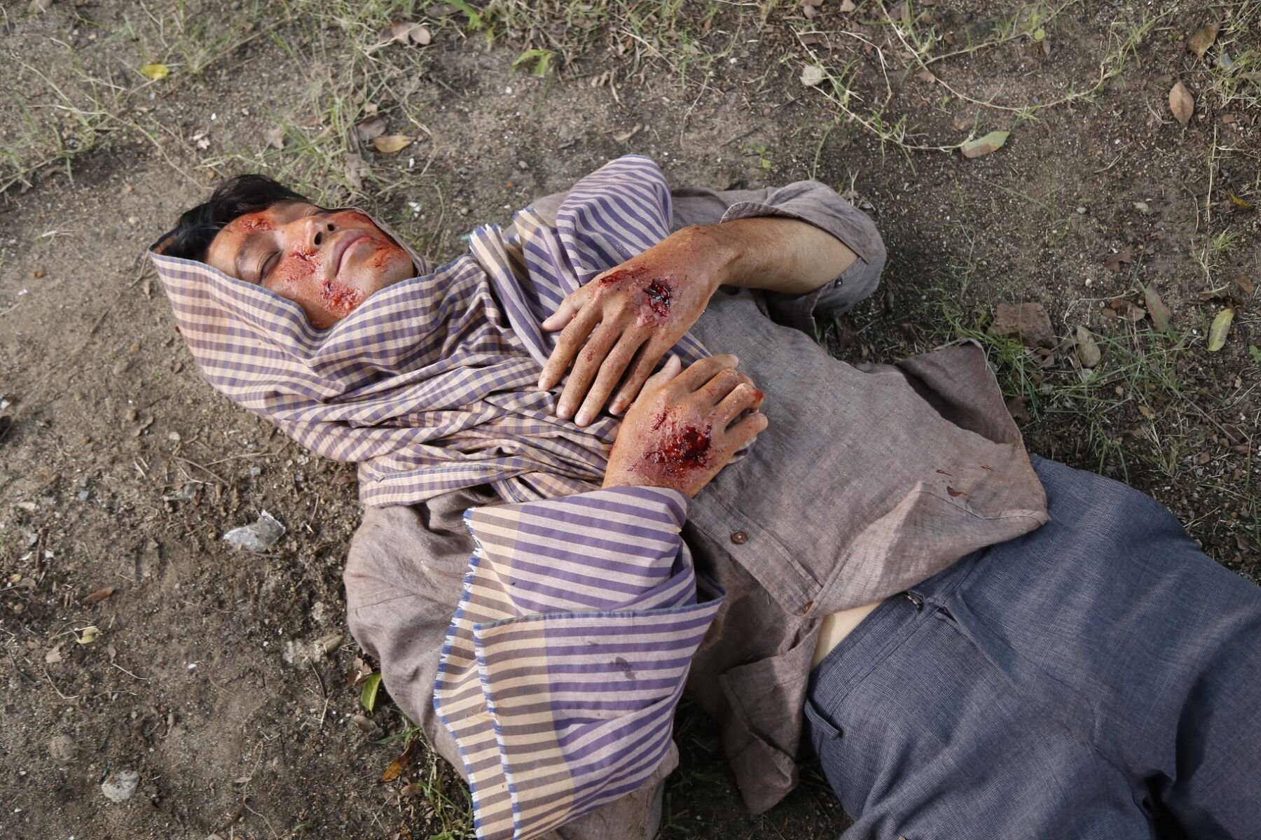 รู้จัก โรคซิฟิลิส ผ่านตัวละคร “ดอกรัก” ในละคร บ่วงใบบุญ ช่อง 8