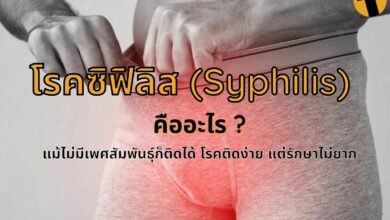 โรคซิฟิลิส (Syphilis)