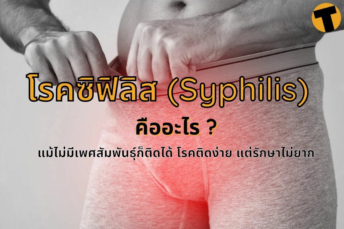 โรคซิฟิลิส (Syphilis)