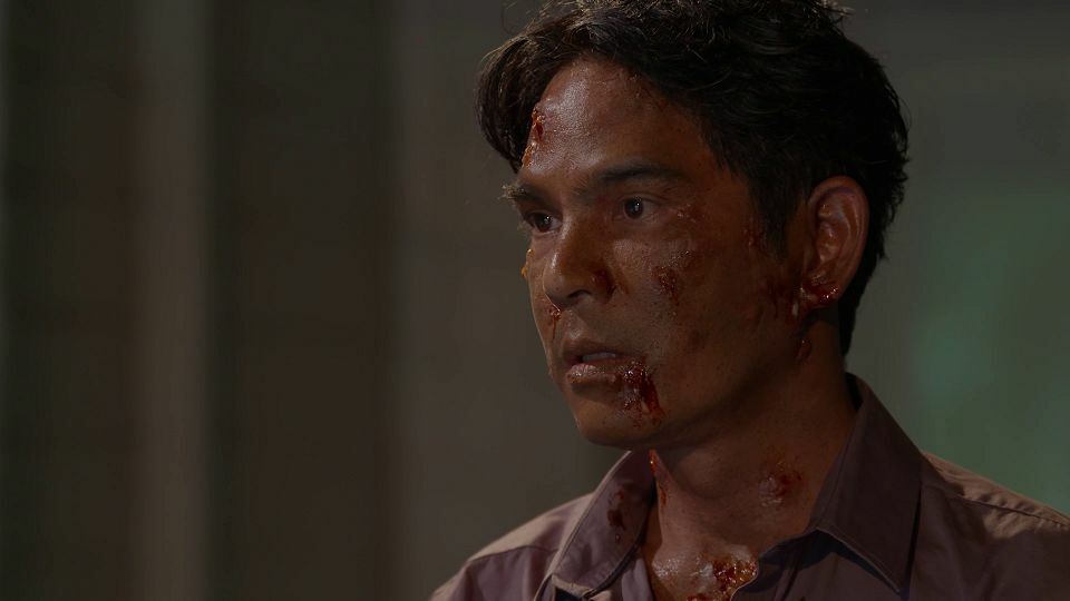 รู้จัก โรคซิฟิลิส ผ่านตัวละคร “ดอกรัก” ในละคร บ่วงใบบุญ ช่อง 8 เกริก