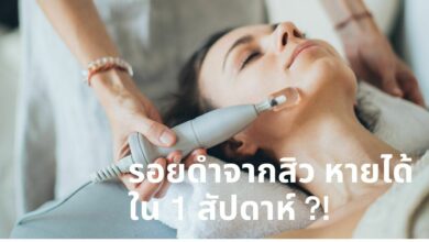 รอยแดงรอยดำ จากสิว