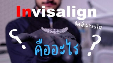 จัดฟันแบบใส