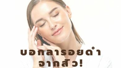 สิวอุดตัน