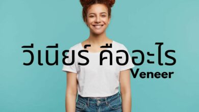 วีเนียร์ คือ