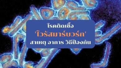 โรคติดเชื้อไวรัสมาร์บวร์ก