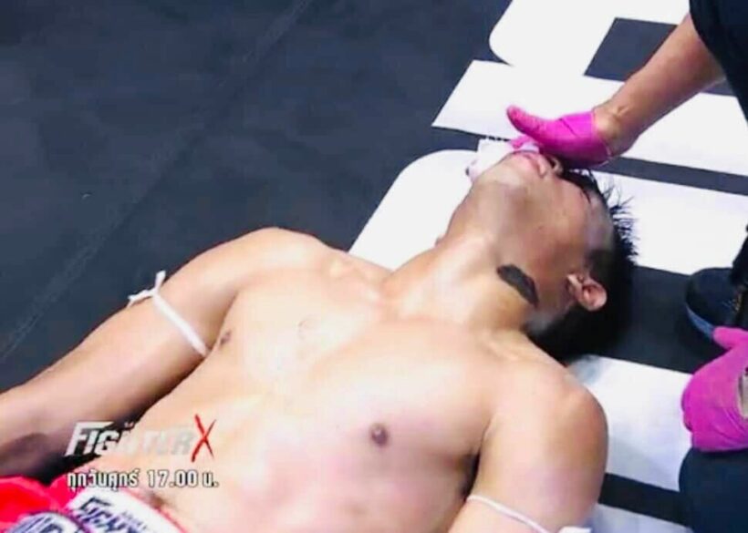 ปานเพชร ยังโคม่าหลังโดนน็อค ด้านภรรยาโพสเศร้า