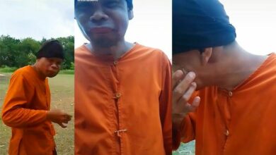 หลวงพี่ถูกแตนต่อยหน้าบวมเป่ง