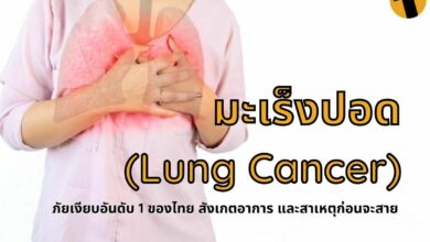 มะเร็งปอด