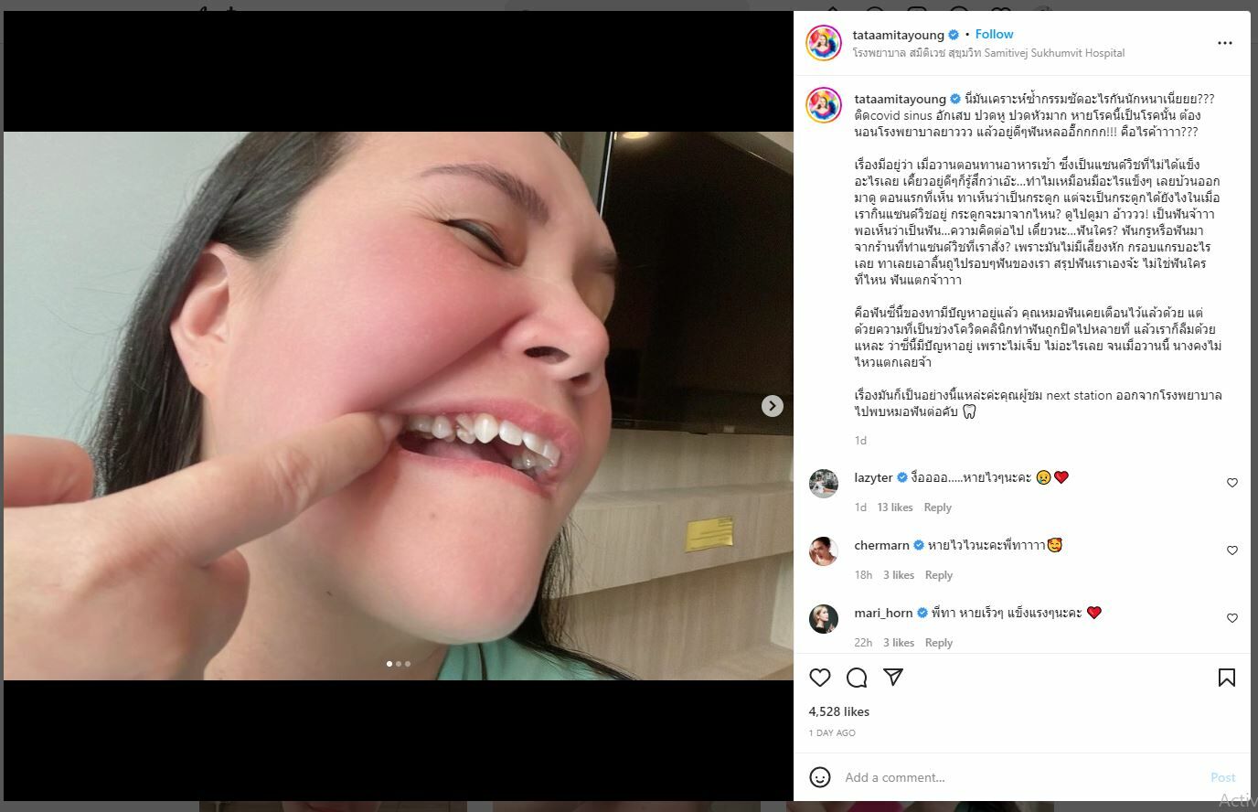 ทาทายัง ฟันแตก