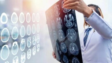 เส้นเลือดในสมองแตก